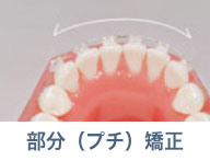 部分（プチ）矯正